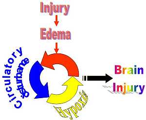 Mechanism of brain injury