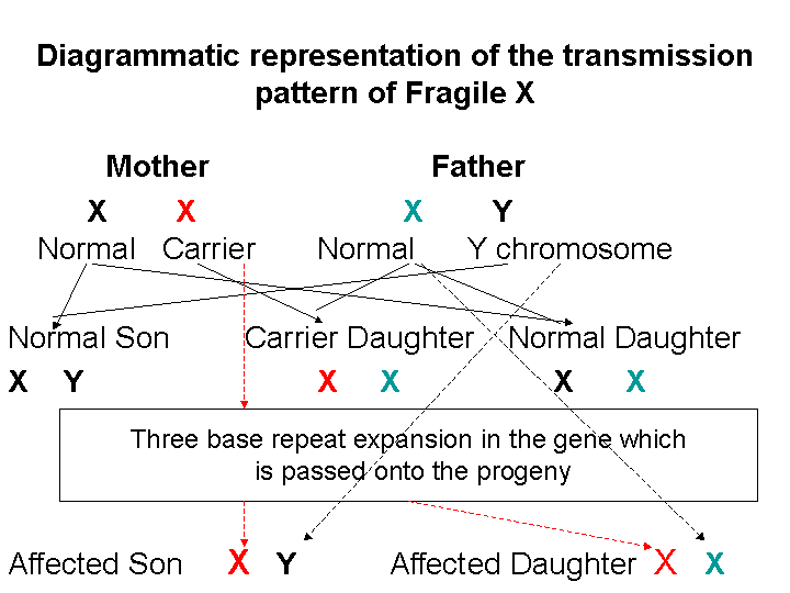 fragile x syndrome chromosome